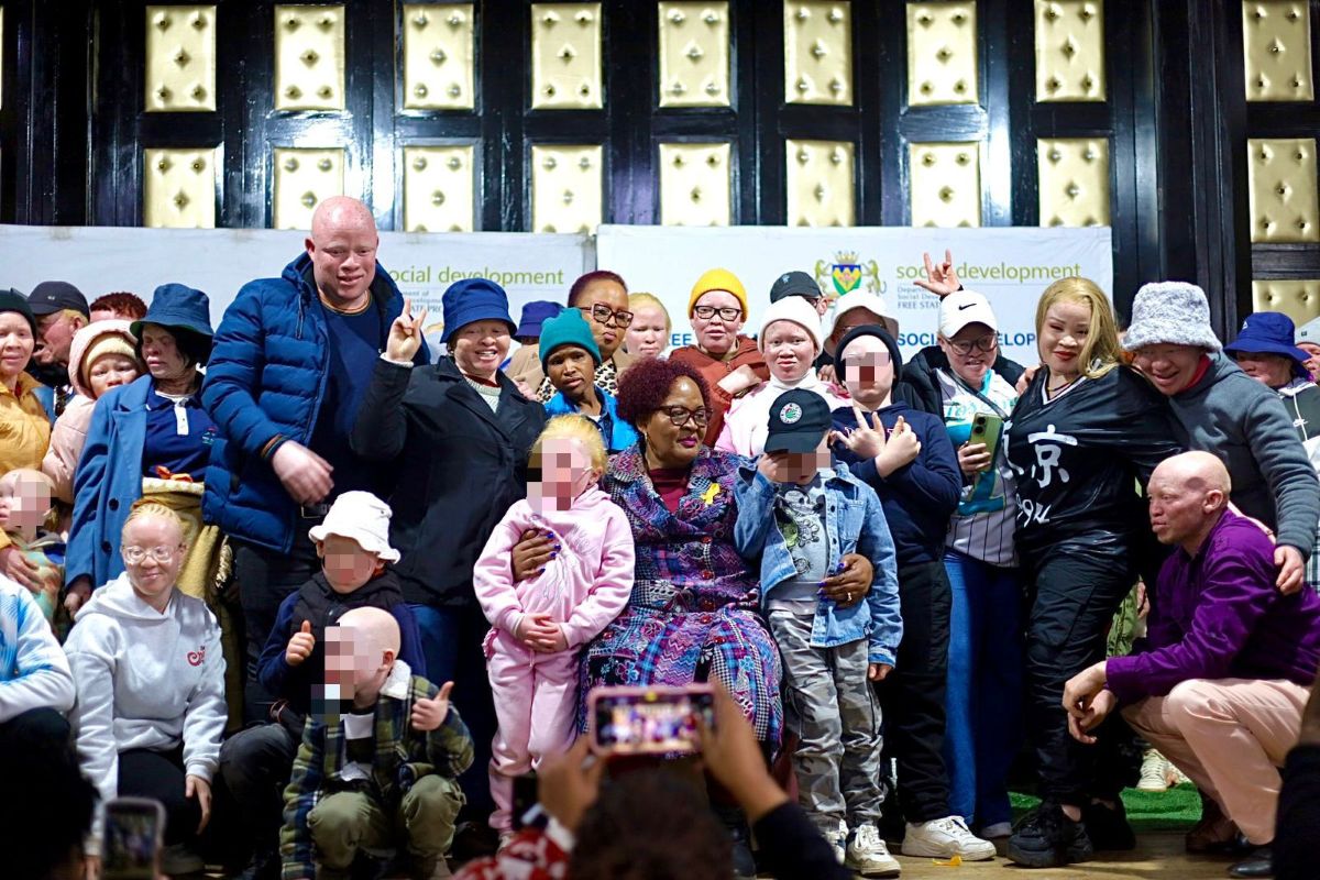 Free State Champions Albinism Rights with Urgent Health and Economic Pledges